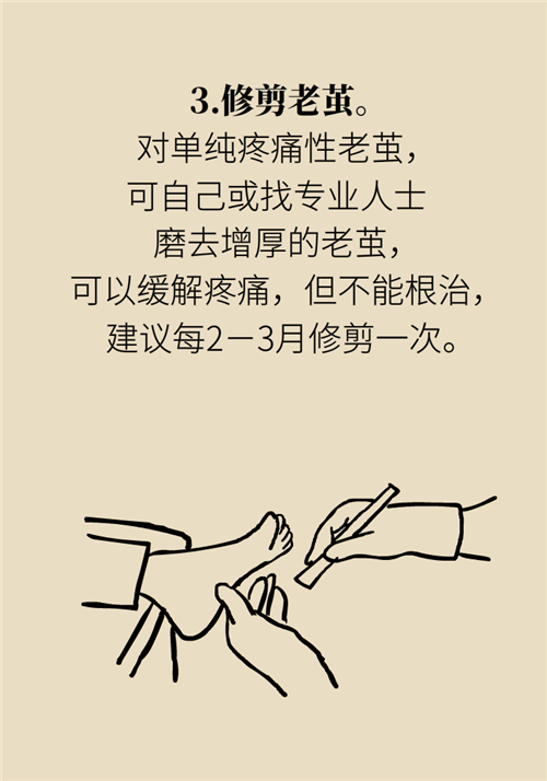 前腳掌起老繭并疼痛？當心這可能是跖痛癥