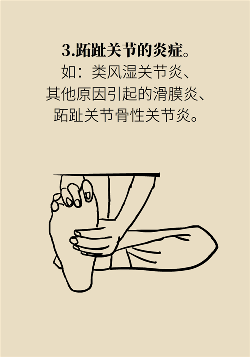 前腳掌起老繭并疼痛？當心這可能是跖痛癥