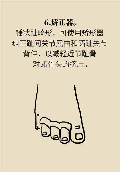 前腳掌起老繭并疼痛？當心這可能是跖痛癥