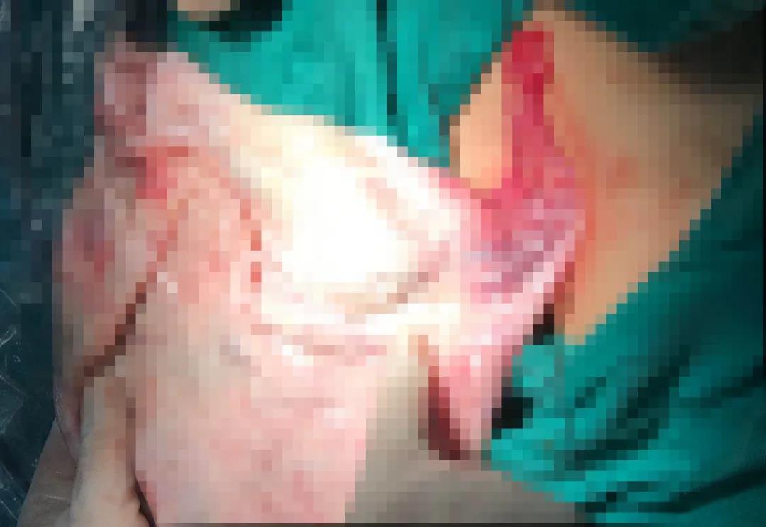 患者千里迢迢回家鄉(xiāng)就醫(yī) 精心救治不負(fù)君來(lái)不負(fù)卿