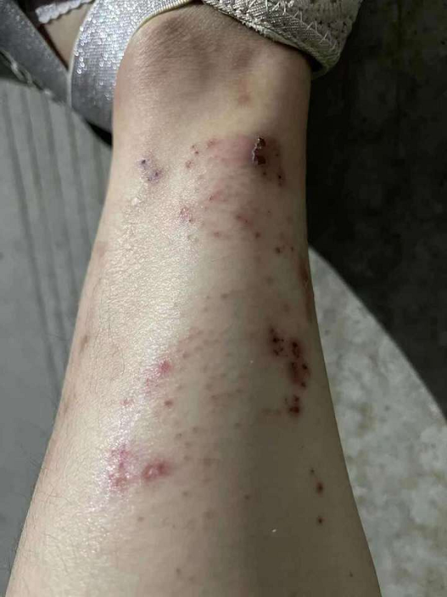 姑娘，你變&ldquo;丑&rdquo;了，卻是我們眼中最美的天使