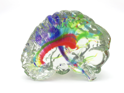 我國多家醫(yī)院正加速&ldquo;3D打印技術(shù)+醫(yī)療&rdquo;落地！將給患者帶來哪些利好？