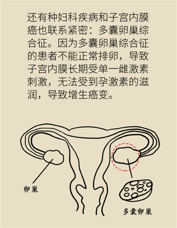 體重超過(guò)這個(gè)指標(biāo)，竟然會(huì)得這種婦科癌癥？