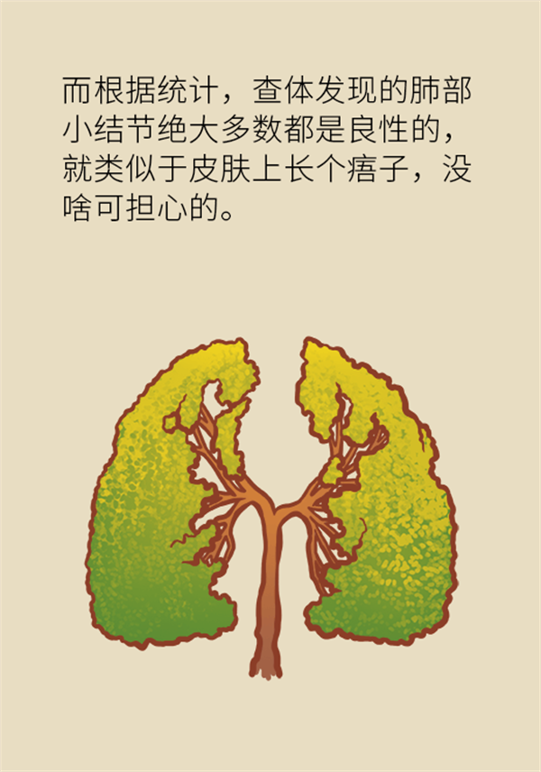 肺部結(jié)節(jié)會變成肺癌嗎？這些人群要警惕