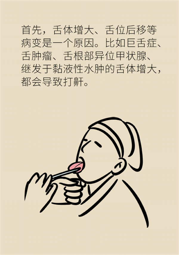 睡覺打鼾怎么辦？6個小妙招輕松緩解