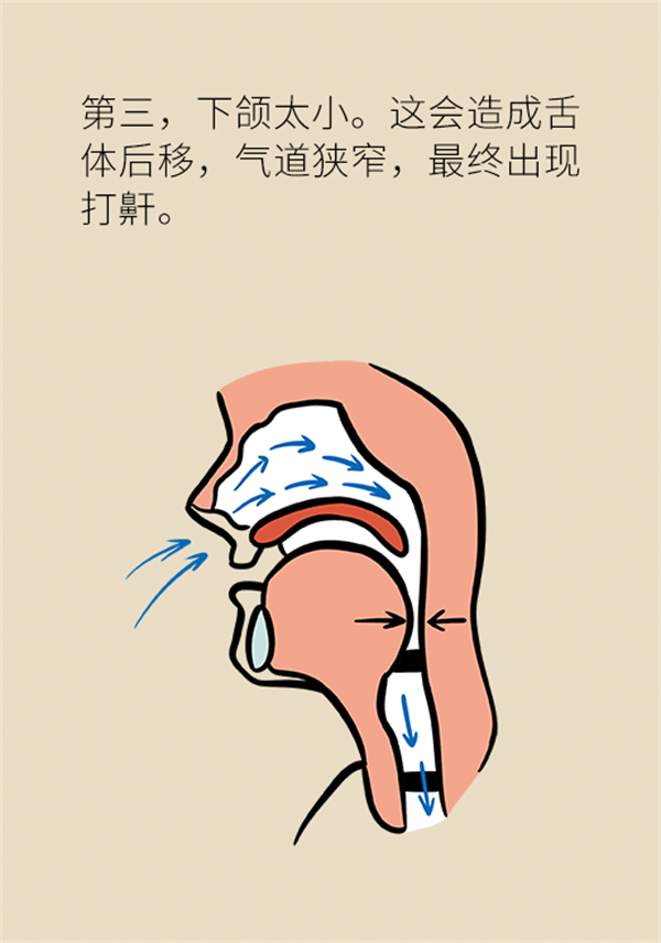 睡覺打鼾怎么辦？6個小妙招輕松緩解