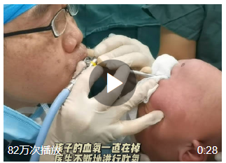 與死神賽跑！#開心果卡進寶寶肺醫(yī)生跪地搶救