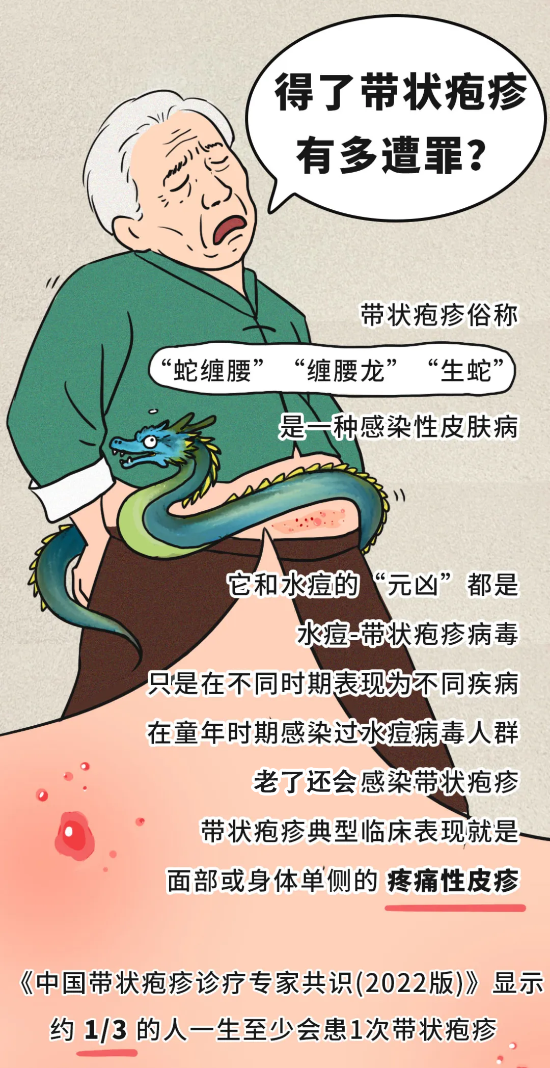 有必要帶爸媽打帶狀皰疹疫苗嗎？一圖了解