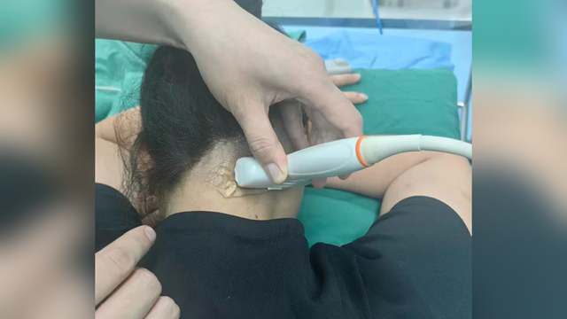 鄭州大學(xué)附屬腦病醫(yī)院（駐馬店市第二人民醫(yī)院）：為破十年偏頭痛，她從廣州來到駐馬店