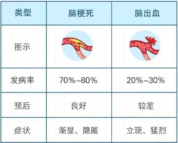 腦梗高發(fā)季到了！有3種不舒服，千萬別大意