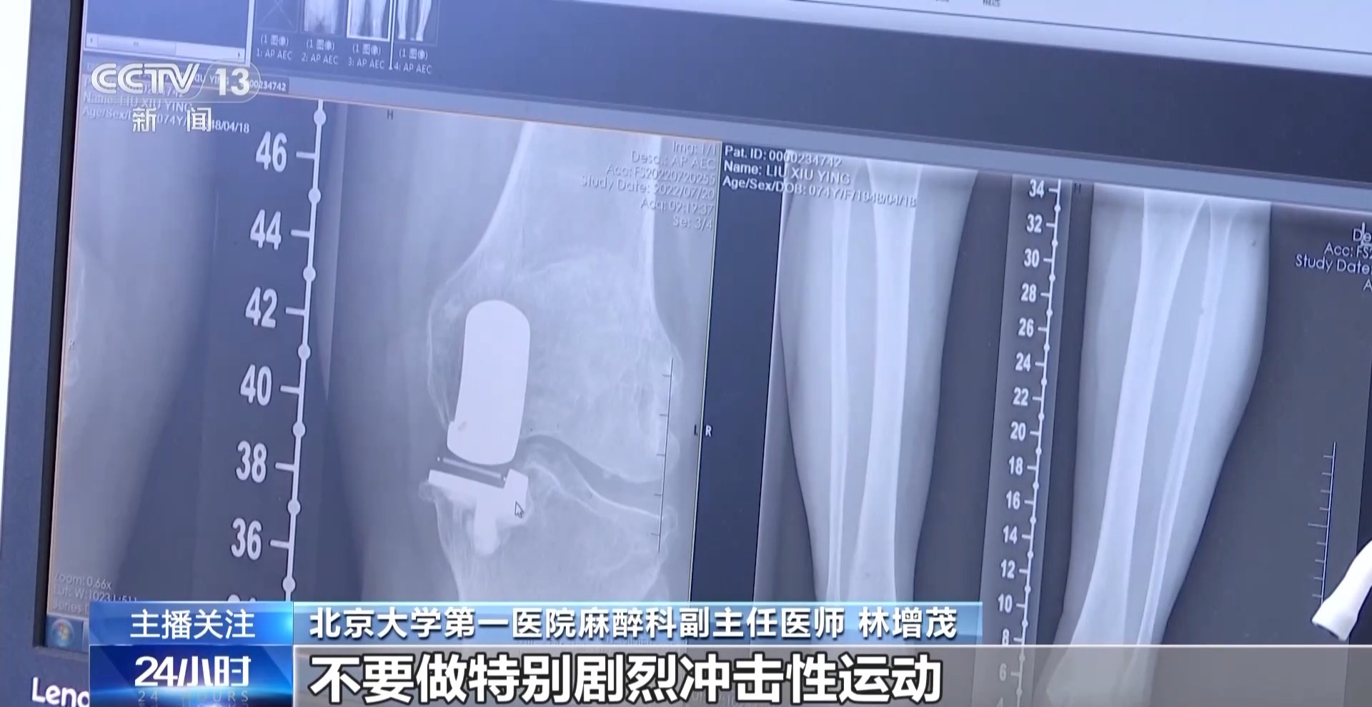 老年人遇到這些身體疼痛勿硬扛 或是健康重要預(yù)警信號