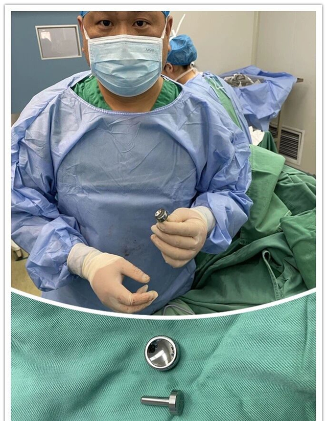 駐馬店市中醫(yī)院成功開展首例人工橈骨頭置換術(shù)