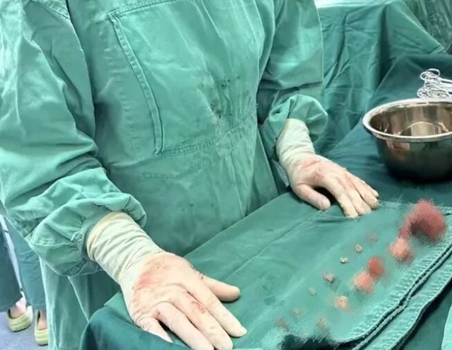 15顆肌瘤，毫米級(jí)“排雷”——駐馬店市中醫(yī)院為患者圓健康夢(mèng)