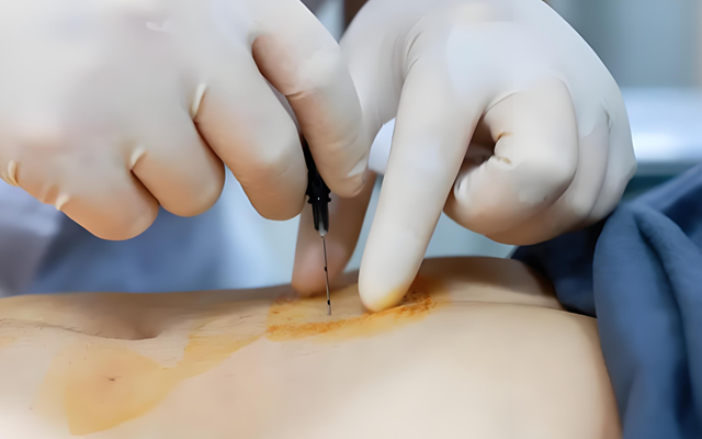 減肥總反彈？那是身體在“報警”！中醫(yī)埋線：不折騰、不挨餓，先把你的易胖體質(zhì)調(diào)回來