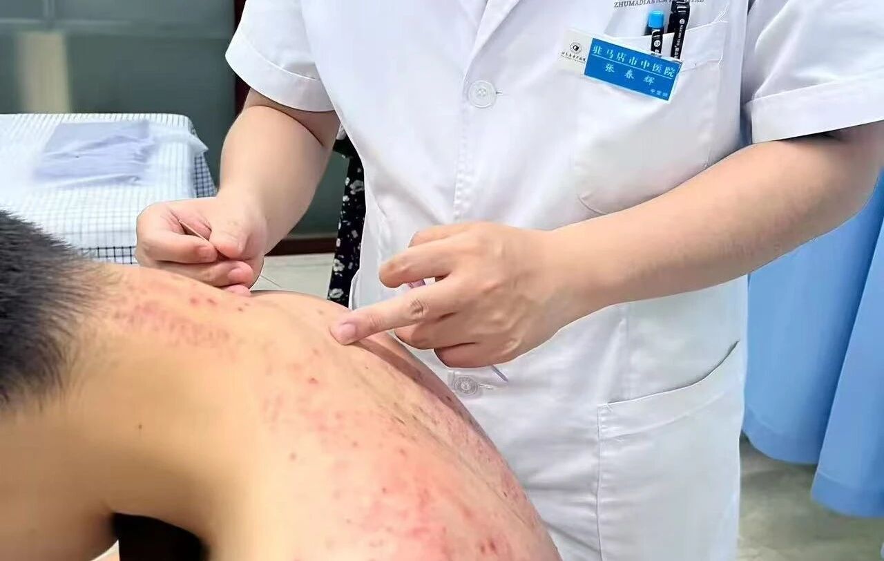 中醫(yī)助長高，春日正當(dāng)時(shí)&mdash;&mdash;2026年駐馬店市中醫(yī)院兒童外治科兒童助長計(jì)劃正式開啟